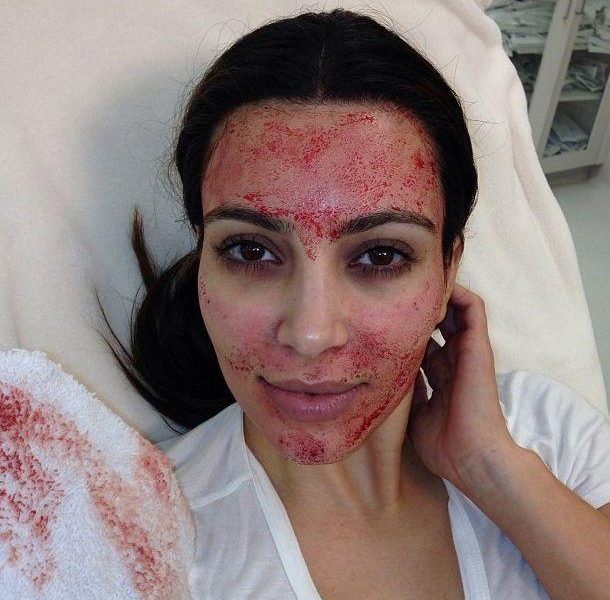 Kim Kardashian after the facial.