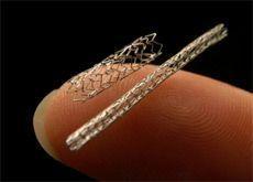 STENT SAVIOUR: A photo of a stent, similar to the one used in Al Ain.