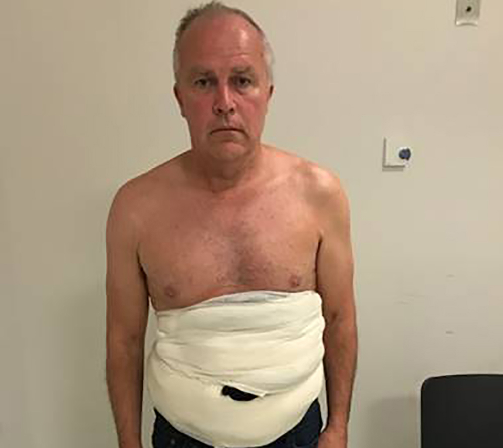 Prolific bird egg smuggler Jeffrey Lendrum with bird eggs stapped to his body in a sling, after arriving in the UK at Heathrow Airport on June 26, 2018. Image: CROWN PROSECTION SERVICE/AFP