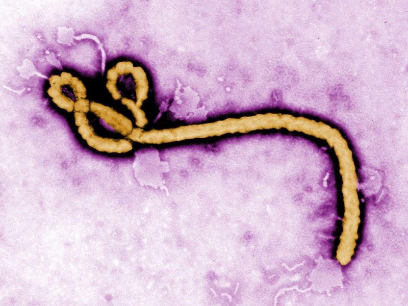 In this handout from the Center for Disease Control (CDC), a colorized transmission electron micrograph of a Ebola virus virion is seen. (Getty Images)