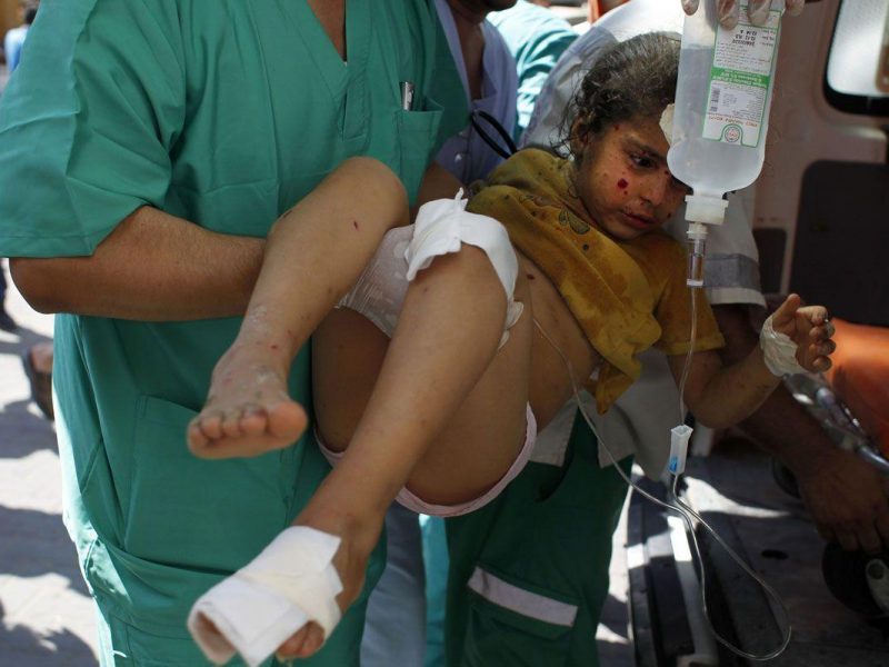 A wounded Palestinian girl arrives at the hospital in Rafah, in the southern Gaza Strip on August 2, 2014 following an Israeli military strike. (AFP/Getty Images)