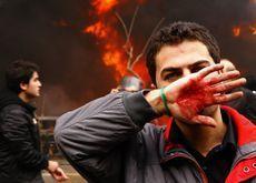 TEHRAN RIOT: A protester covers his face with his bloodstained hand during Sundays violence. (Getty Images)