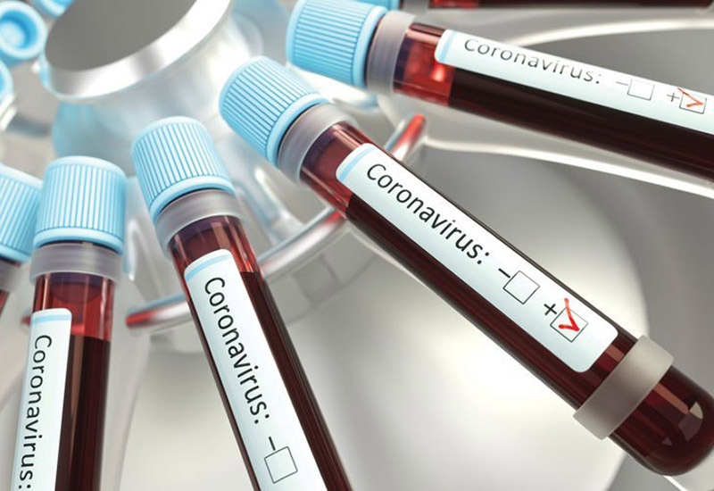 Coronavirus: Number of confirmed Covid-19 cases in UAE falls for second day